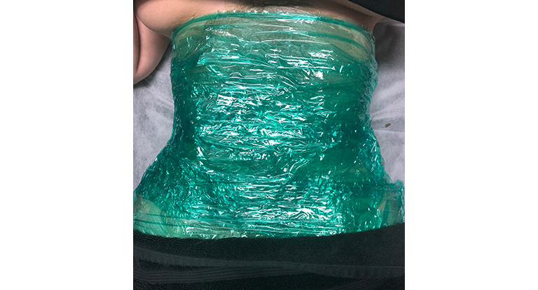Abdpminal-wrap-2