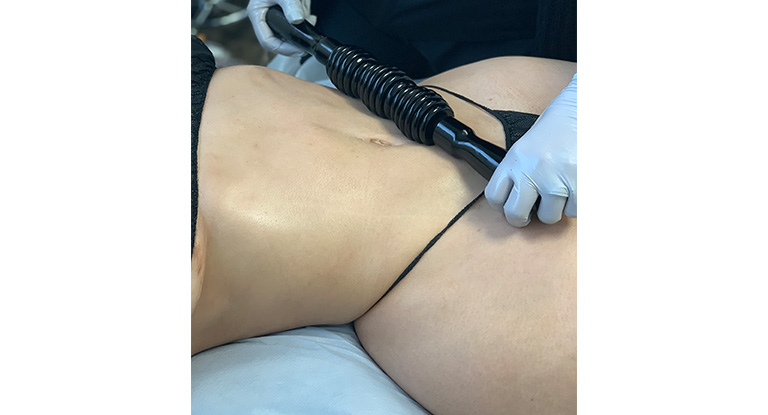 Cellulite-treatments-wood RBDAY Spa services in Lynwood at RB Day Spa