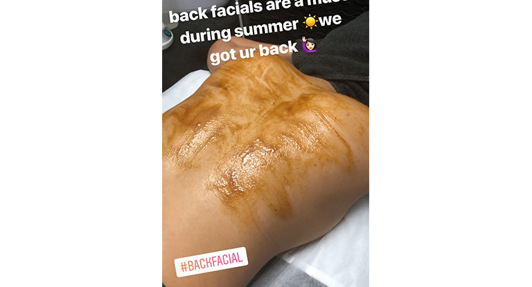 Back-facial2 RBDAY Spa services in Lynwood at RB Day Spa