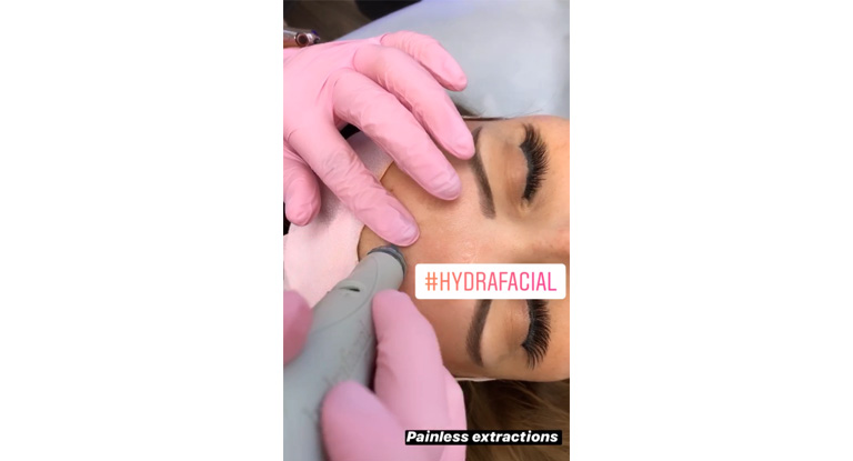 Hydrafacial